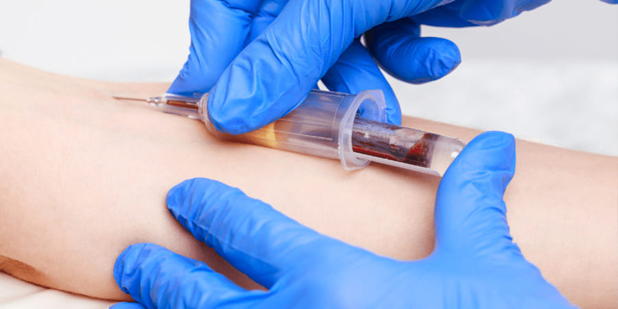Toma de muestra y exámenes